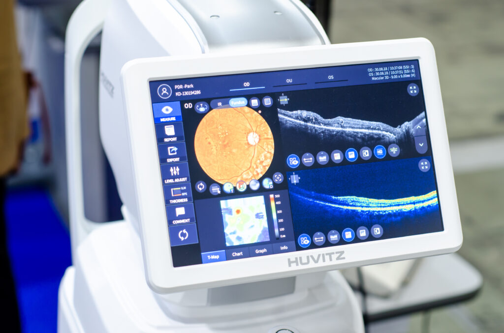 Nahaufnahme eines Huvitz-Geräts, auf dessen Bildschirm Bilder der Angiographie am Auge und detaillierte Diagnosedaten angezeigt werden.